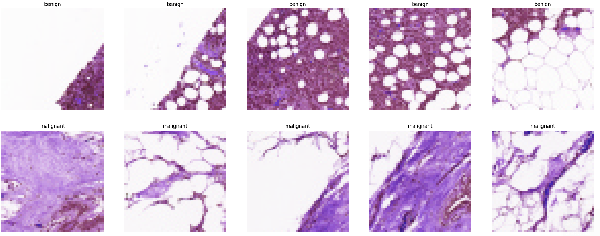 Breast Histopathology Image Segmentation